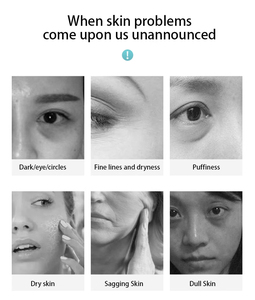 Soin des yeux professionnel, réduit les ridules, améliore les rides, lifting du visage, rétrécissement des pores, améliore les poches sous les yeux, lifting des yeux, soin du visage - Product Image 5