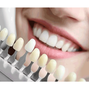 CE High Quality Electric 8 LED Teeth Whitening Device <b>with</b> 3 Color Options and 1-20s <b>Timer</b> - Product Image 5