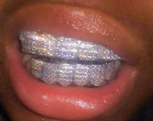 Grillz de luxe personnalisés en argent 925 avec moissanite, style hip-hop, faits à la main, effet VVS, design de bijoux haut de gamme - Product Image 1