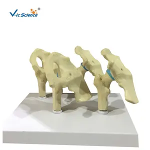 Arthritic Hip Anatomy Model human ankle anatomical model hand anatomical models 4 parts