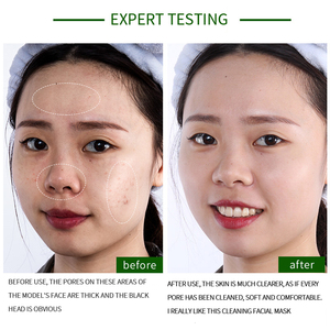 ผลิตภัณฑ์ดูแลผิวหน้า OEM Bioaqua มาส์กโคลนฟองคาร์บอนด์ บำรุงผิวอย่างล้ำลึก - Product Image 3