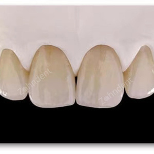 Zahndent Nhà Máy Trực Tiếp Giá 43% Độ Trong mờ 1200mpa Độ <span class=keywords><strong>B</strong></span>ền Uốn St Nha Khoa Zirconia Khối - Product Image 5