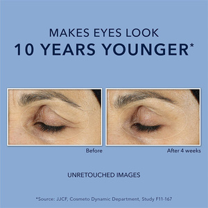 Crème pour les yeux lissante au rétinol de haute qualité à prix avantageux, en vente flash, avec acide hyaluronique, hydratant organique anti-rides - Product Image 6
