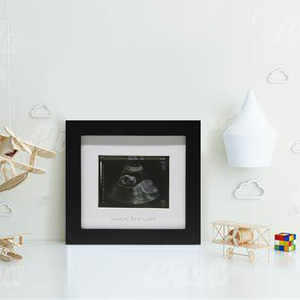 Marco de Fotos para Ecografías de Bebé con Múltiples Sentimientos, Decoración para el Hogar, Gran Producto en Tendencia 2026 - Product Image 3