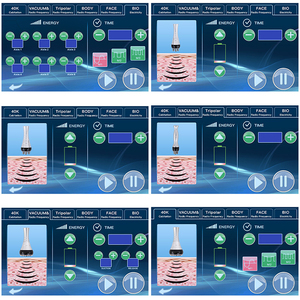 40 k Cavitation Rf <span class=keywords><strong>Lipocavitation</strong></span> Lipo Laser Ems Perte de poids Appareil d'amincissement 6 En 1 pour sculpter le corps - Product Image 5