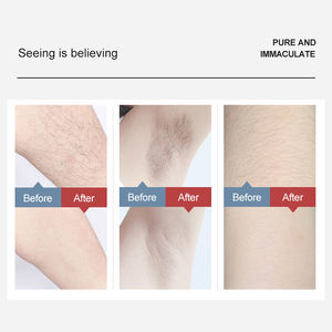 Refroidissement de qualité garantie, outil de soins personnels, 1 pièce, Laser d'épilation Ipl - Product Image 6