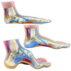 Comparación Patológica Modelo Pie Normal/Plano/Arco Precio - Product Image 3