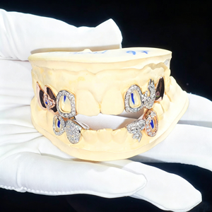 Custom Vvs Moissanite Open Face Grillz Estilo Hip Hop Iced Out Round Brilliant Cut Diamond 925 Silver Teeth Grillz - Product Image 2