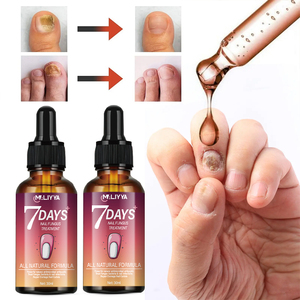 Nhãn hiệu riêng 7 ngày điều trị nấm móng tay tinh chất sử<span class=keywords><strong>a</strong></span> chữ<span class=keywords><strong>a</strong></span> vi khuẩn thô móng đổi màu giòn chăm sóc móng sử<span class=keywords><strong>a</strong></span> chữ<span class=keywords><strong>a</strong></span> tinh chất - Product Image 3