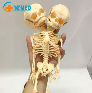 Modelo <span class=keywords><strong>de</strong></span> <span class=keywords><strong>Esqueleto</strong></span> Fetal Deformado <span class=keywords><strong>de</strong></span> Doble Cabeza para Demostraciones <span class=keywords><strong>de</strong></span> Enseñanza <span class=keywords><strong>de</strong></span> Ciencias Médicas, Modelo <span class=keywords><strong>de</strong></span> <span class=keywords><strong>Esqueleto</strong></span> <span class=keywords><strong>Humano</strong></span> <span class=keywords><strong>de</strong></span> Bebé, CE\ISO - Product Image 2
