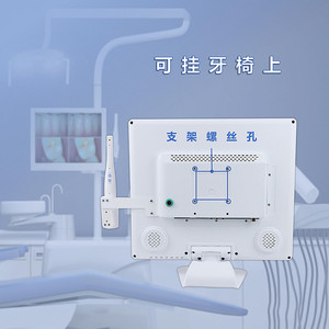Sistema de Endoscopia Dental con Monitor de 17 Pulgadas, 800W Píxeles, Equipo Médico de Observación Oral - Product Image 2