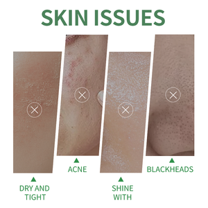 Masque facial vert en stick pour peaux sujettes à l'acné, stick d'<span class=keywords><strong>argile</strong></span> nettoyant les pores et contrôlant le sébum, soin naturel végétalien par GREENLEM - Product Image 5