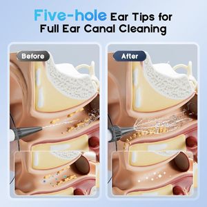 Electric Ear <b>Wax</b> <b>Remover</b> Portable Ear Cleaning Device with Ear Irrigation <b>Kit</b> - Product Image 3