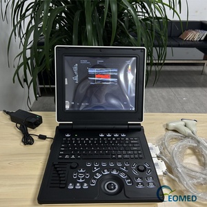 Échographe Doppler Couleur Portable pour Ordinateur Portable avec Logiciel 3D – Appareil d'Échographie Doppler pour Gynécologie, Cardiologie, Vétérinaire et Échographie de Grossesse CU20 - Product Image 3
