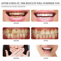 Ventes directes d'usine OEM/ODM Emballage personnalisé Logo de couleur Ingrédients personnalisables Dentifrice blanchissant