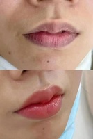 Crème Blanchissante Rose de Haute Qualité pour Zones Intimes, Traitement de l'Hyperpigmentation des Aréoles et Parties Intimes
