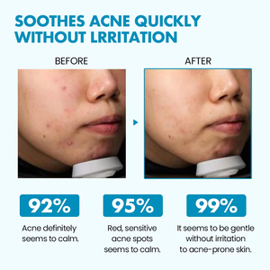 <span class=keywords><strong>Lotion</strong></span> corporelle végane à la niacinamide, au tea tree et à la centella asiatica <span class=keywords><strong>AHA</strong></span>+<span class=keywords><strong>BHA</strong></span>+<span class=keywords><strong>PHA</strong></span>, apaisante et hydratante pour les peaux sensibles - Product Image 5