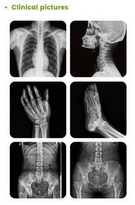 Sistema de radiografía digital 32kw monofásico 110V Máquina DE RAYOS X avanzada de doble columna para hospital - Product Image 6