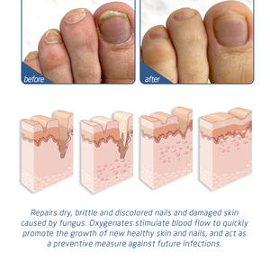 Spray pour les pieds South Moon, anti-odeur, antibactérien, ingrédients naturels, hautement efficace - Product Image 5