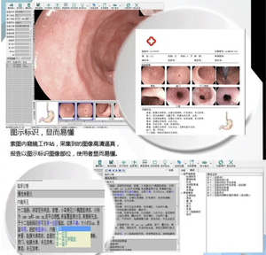 ซอฟต์แวร์รายงานผลการส่องกล้องทางการแพทย์สำหรับการสร้างและแชร์รายงานผลการส่องกล้องอย่างมืออาชีพ ViewPoint 6 - Product Image 3