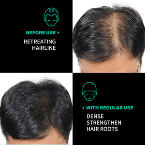 Tóc nhanh chóng tăng trưởng batana dầu điều trị rụng tóc-Nuôi dưỡng rễ tóc tames xoăn cứng & tăng cường êm ái - Product Image 5