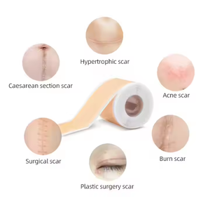 Vente en gros <span class=keywords><strong>de</strong></span> ruban adhésif cicatrisant en <span class=keywords><strong>silicone</strong></span> transparent, imperméable, hypoallergénique, ultra-fin, <span class=keywords><strong>de</strong></span> qualité médicale, gel <span class=keywords><strong>de</strong></span> <span class=keywords><strong>silicone</strong></span> pour la réparation des cicatrices, 4 cm * 1,5 m - Product Image 5