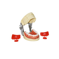 Modèle d'entraînement dentaire à 28 dents amovibles, gencives en silicone souple, base à charnière métallique, pour la pratique et l'enseignement des implants dentaires