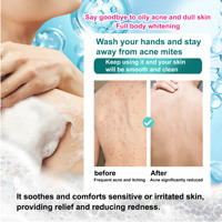 Savon Solide Artisanal Hydratant et Nettoyant en Profondeur à la Rose, à l'Acide Kojique, pour le Commerce International Transfrontalier en Afrique