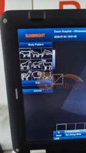 Draagbare VET-laptop 3D PW medische elastografie echografiemachine 15 inch kleuren Doppler sonografie <span class=keywords><strong>USG</strong></span>-apparaat - Product Image 2