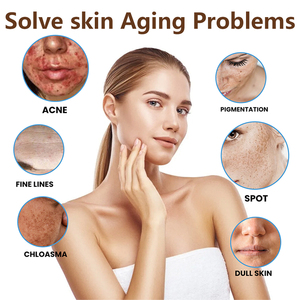 <span class=keywords><strong>Crema</strong></span> facial de cúrcuma para la eliminación del acné Cuidado DE LA PIEL Brillo Reafirmante e hidratante en stock - Product Image 3