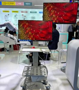 Colposcopio Digital con Cámara 4K Full HD, Sistema de Imágenes con Función Estable para Detección de Cáncer Cervical y Exámenes Ginecológicos - Product Image 5