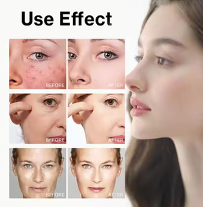 Maßgeschneidertes Veganes Bio-Luxus Gesichtspflege-Serum mit 7% Glykolsäure und Hyaluronsäure Flüssiges Feuchtigkeitsspendendes Peeling-Serum für Alle Hauttypen - Product Image 5