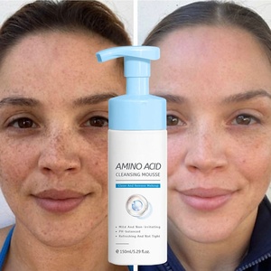 <span class=keywords><strong>Espuma</strong></span> de limpieza de arroz hidratante OEM <span class=keywords><strong>con</strong></span> ácido hialurónico vitamina C perla de té verde para aclarar para uso <span class=keywords><strong>facial</strong></span> - Product Image 5