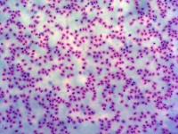 Mixed Tissue & Cell for Students Teaching and Lab Study Middle School Biology Slide Kit 25 Pcs Set Prepared Slides ISO