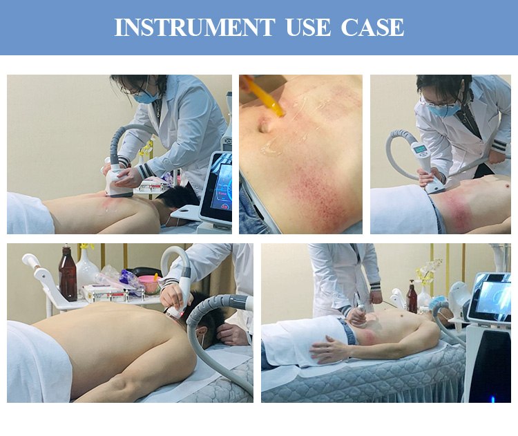 Bieir vela vacuum roller RF cavitation fat burning slimming machine beauty salon SPA equipment