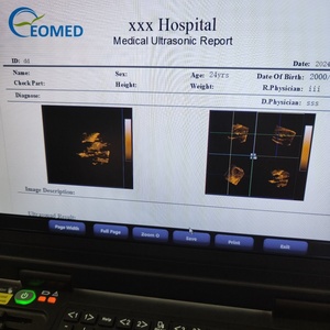 Appareils d'échographie 3D portables médicaux, échographe couleur portable Doppler, meilleur prix pour vétérinaire et humain CU20 - Product Image 6