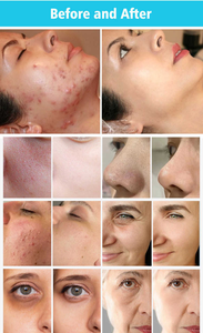 Appareil professionnel de soin du visage hydroélectrique ABS 9 en 1, microcourant, lifting du visage, anti-rides, pour salon - Product Image 6