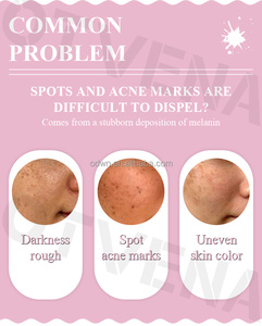 El favorito del cliente Blanqueamiento rápido Corrección de manchas <span class=keywords><strong>Mejor</strong></span> crema justa para la cara - Product Image 6