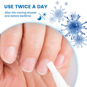 Sumifun Hot Selling Effectieve Pijnloze Nagels Anti Bacteriën Nagel Schimmel Behandeling Vloeistof - Product Image 5