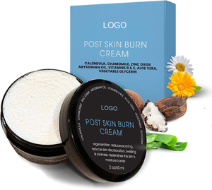 Etiqueta privada Post Skin Burn Cream Sunburn Cream <span class=keywords><strong>para</strong></span> el tratamiento de primeros auxilios Hidrata repara la piel con <span class=keywords><strong>heridas</strong></span> de manteca de karité de <span class=keywords><strong>Aloe</strong></span> Vera - Product Image 1
