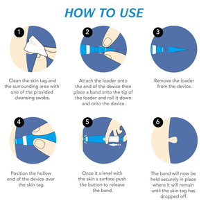 Оптовая продажа, набор для удаления бородавок ALIVER, удаление бородавок с чистящими тампонами - Product Image 5