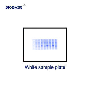 BIOBASE China Sistema automático de imágenes de documentos en gel Equipo de electroforesis en gel para laboratorio médico Precio de fábrica - Product Image 4