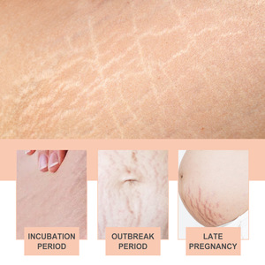 La crema de Caracol al por mayor más vendida para <span class=keywords><strong>el</strong></span> cuerpo antiestrías, líneas finas y cicatrices, cuidado suave con piel suave - Product Image 5