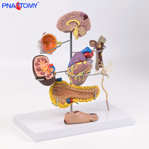 Modelo Anatómico Médico <span class=keywords><strong>de</strong></span> Diabetes <span class=keywords><strong>de</strong></span> 8 Partes, Desmontable, <span class=keywords><strong>de</strong></span> PVC, con Globo Ocular, Corazón, Riñón, Vasos Sanguíneos y Pie, con Patología - Product Image 2