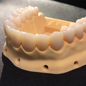 <span class=keywords><strong>Riton</strong></span>-impresora 3d de metal para odontología, D-120 equipo dental, slm, digital - Product Image 3
