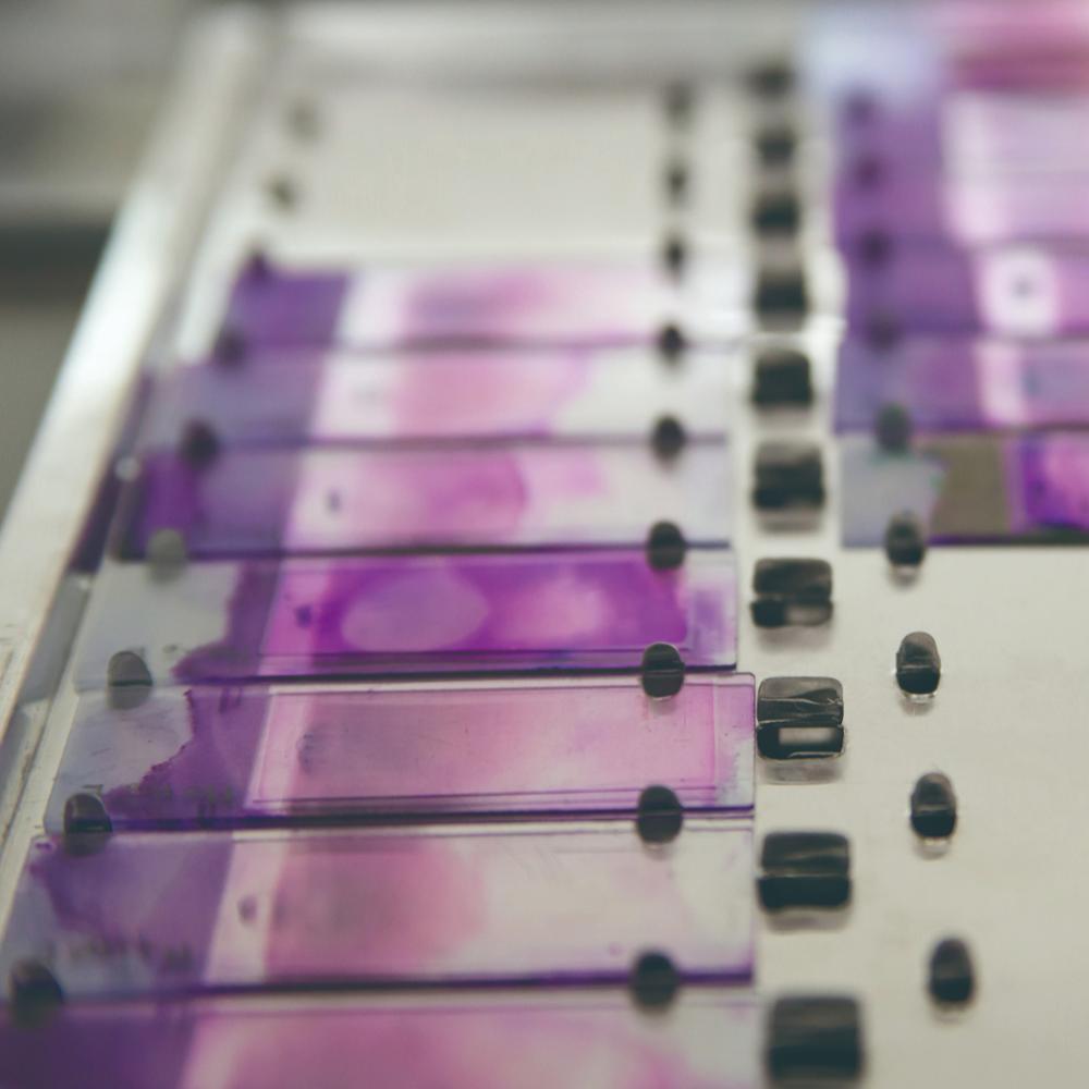 Оптовая продажа, микроскоп для размазки крови, готовый микроскоп, слайды, лабораторные расходные материалы