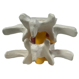 Model kerangka sains medis, untuk demonstrasi herniasi Lumbar bahan PVC untuk pelatihan perawat di sekolah - Product Image 4
