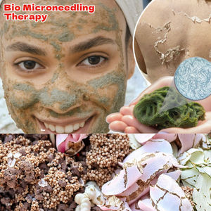 Terapia de Biomicroneedling OEM/ODM con Espículas de Esponja para Eliminar el Acné del Rostro y la Nariz, Antialérgico, Sin Sulfatos, Sin Ácidos, Sin Uso Médico - Product Image 3