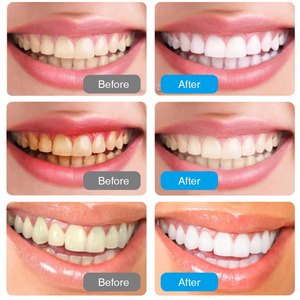 Élimination des odeurs de charbon de coco activé naturel de qualité supérieure blanchissant végétalien sans fluorure dentifrice au charbon de bambou noir - Product Image 6