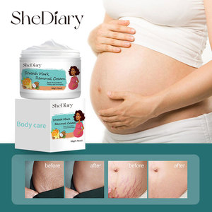 Tùy Chỉnh Tự Nhiên Mang Thai Mịn Căng Đánh Dấu Loại Bỏ Kem Chống-Căng Đánh Dấu Loại Bỏ Vết Sẹo Cho Cơ Thể OEM ODM Nhãn Hiệu Riêng - Product Image 5